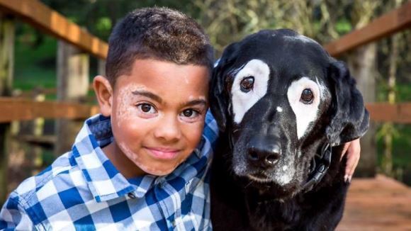 Se ura din cauza condiţiei cronice de care suferea, până ce şi-a întâlnit câinele-geamăn. Povestea impresionantă a unui băieţel bolnav de vitiligo – Galarie foto